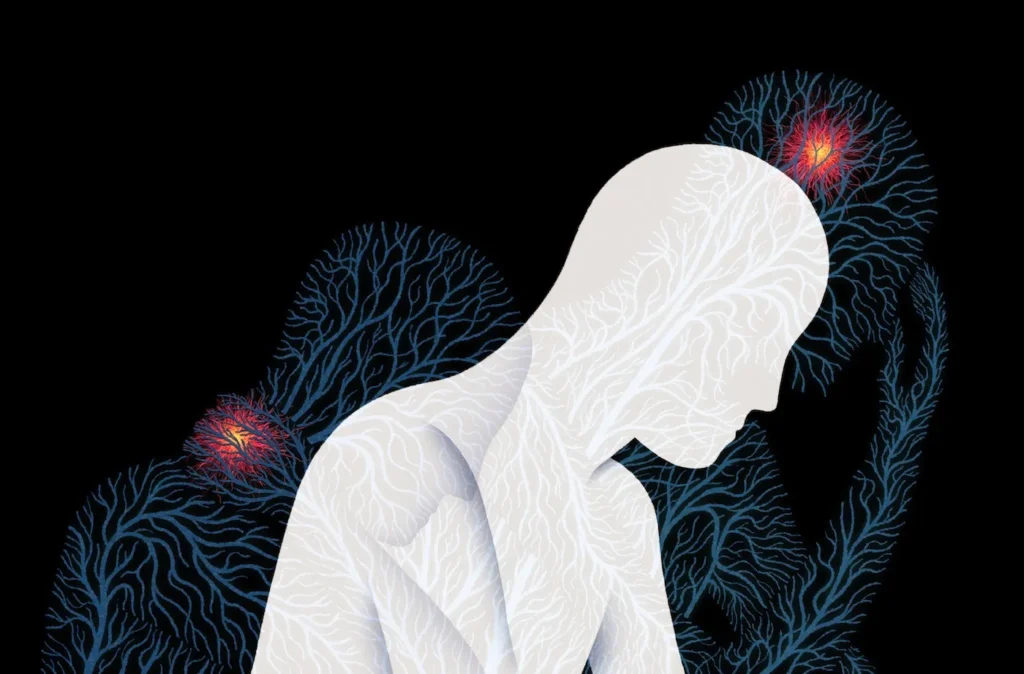 만성 통증 환자를 위한 심리 치료와 재활 프로그램을 설명하는 의료·심리 통합 인포그래픽